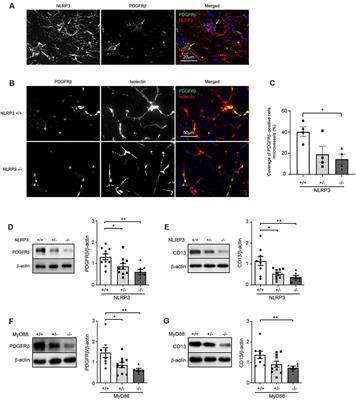 NLRP3 Is Involved in the Maintenance of Cerebral Pericytes